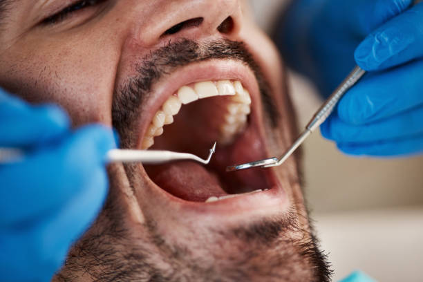 Best Urgent Care for Lost Fillings or Crowns in Clinton, MD